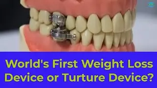 Dental Weight Loss Device | Dental Slim Diet Control | Weight Loss Lock Mouth