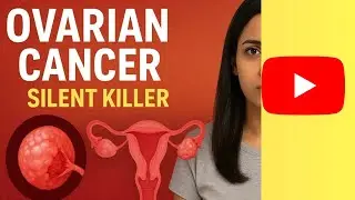 Ovarian cancer A SILENT KILLER #ovariancancer #ovariancyst #dr.shubh