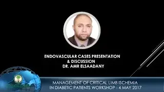 Endovascular Cases Presentation –  Dr  Amr Elsaadany   Discussion – Part II