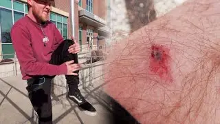 THIS SPOT KEEPS BEATING BEATING ME UP