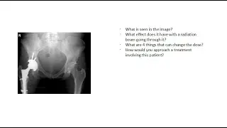 Hip Prosthetic in Radiotherapy ABR Part III Prep/Overview