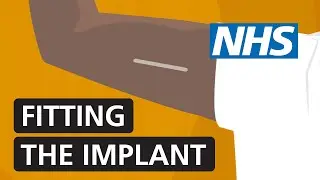 Fitting the contraceptive implant | NHS