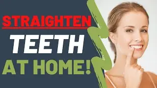 Straighten Your Teeth At Home NATURALLY | Dentist UPDATED (2021)