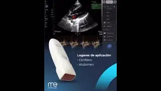 MediExpert: PM4H  - Doppler contínuo