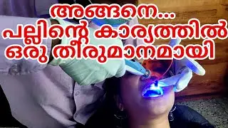 അങ്ങനെ പല്ലിന്റെ കാര്യത്തിൽ ഒരു തീരുമാനം ആയി 🦷🦷