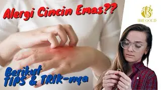 ALERGI PAKE EMAS ? TIPS  SEPUTAR ALERGI CINCIN TUNANGAN DARI EMAS INI PATUT DICOBA LOH