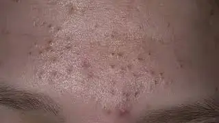 Домашняя маска от черных точек отзывы