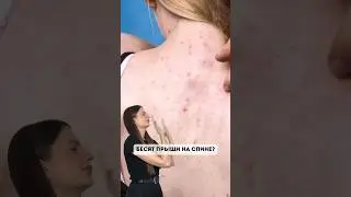 Бесят прыщи на спине Арт. на WB:❤️ 139625239 пенка с аминокислотами ❤️ 124736264 крем с мочевиной