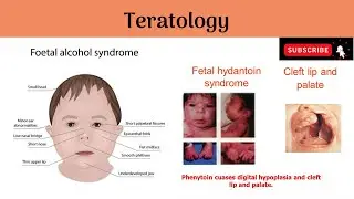 Teratology | Causes of Malformations | Mode of actions of Teratogens #Anatomy #mbbs #education