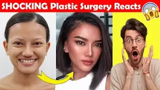 SHOCKING Plastic Surgery Transformation |  Shocking Transformation Before And After Plastic Surgery
