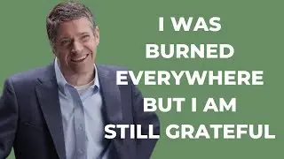 I was burned everywhere and expected to die