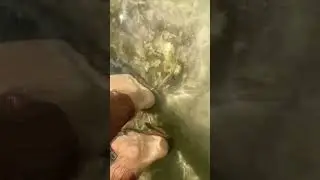 Пираньи сгрызают ногу