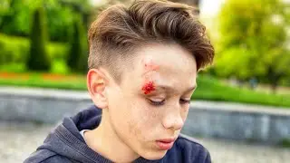 РАЗБИЛ ГОЛОВУ НА СКЕЙТЕ