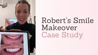 Robert‘s Smile Makeover Case Study︱Dentistry On The Square