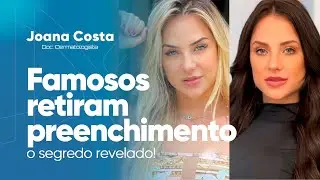 Por Que Famosos Estão Retirando Preenchimentos – Descubra o Segredo da Beleza | Doutora Joana Costa