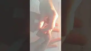 Су джок Семянотерапия☘ при импотенции. 