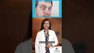 Thyroid Disease and Its Impact On Your Eyes 