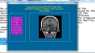 digital image processing projects for final year | digital image processing thesis for final year