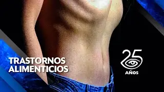 Trastornos alimenticios - Día a Día - Teleamazonas