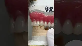 Upper Denture Try-In @EnvisiontecMain​⁠ #envisiontec #lsk121shorts #dental #teeth