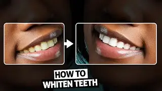 How to WHITEN TEETH in Photoshop | Easy Retouching Tutorial