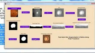 digital image processing project topics | digital image processing thesis topics