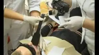 Estetinis plombavimas "Studiodentis.lt