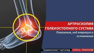 Артроскопия голеностопного сустава - показания к операции, как проходит, осложнения и реабилитация