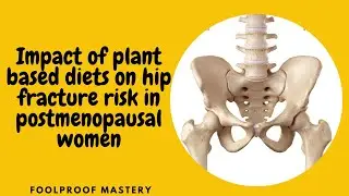 Research Paper Summary: Plant-Based Diets and Risk of Hip Fracture in Postmenopausal Women