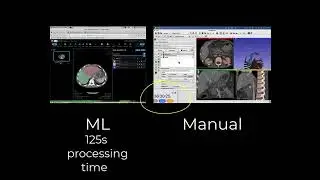 Machine Learning vs Manual with AR