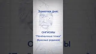 Онгиомы на теле печëночные точки по коже мелкие красные родинки в рассыпную на определëных участках