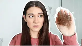 Hair Loss Treatment + TIPS For Hair Growth !