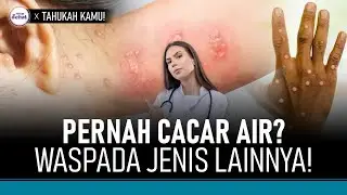 Orang yang Pernah Cacar Air Lebih Mudah Terkena Jenis Cacar Ini! | Hidup Sehat tvOne
