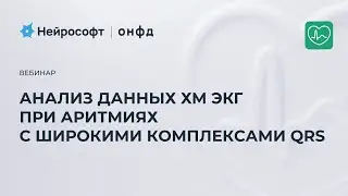 Анализ данных холтеровского мониторирования экг при аритмиях с широкими комплексами QRS