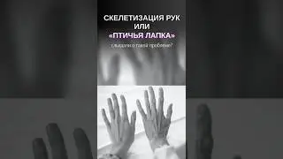 Скелетизация тыла кистей: слышали о такой проблеме? Смотрите до конца. Подписывайтесь, здесь💯польза