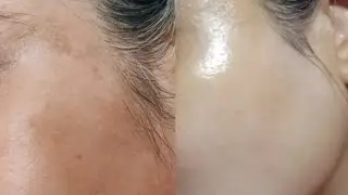 Skin Whitening Facial kit || Free Organic Harvest Vitamin C Facial kit Honest Review 👍 OR 👎#skin