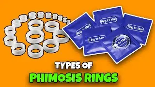 Types of Phimosis Rings (silicone, Plastic, Rubber)