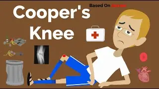 Cooper's Knee
