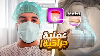 سويت عملية جراحية !! ( معاناة 20 سنة )