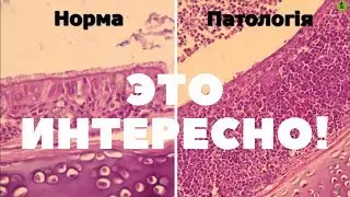 INFECTIOUS BRONCHITIS (IB) in chickens