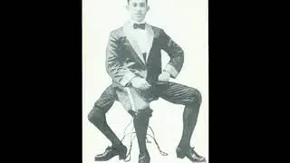 944- Teatro Dos Gnomos- Frank Lentini (The Man With Three Legs) (30-09-2.013)