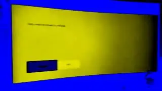 Xbox One Sorry. Could Not Connect To Youtube. FIX!!! Internet In ChordedCityNight