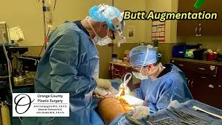 Butt Augmentation | Orange County Plastic Surgery 