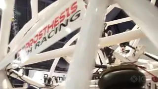 Экзоскелет Prosthesis