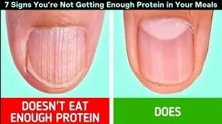 7 Signs You’re Not Getting Enough Protein in Your Meals | How To Video