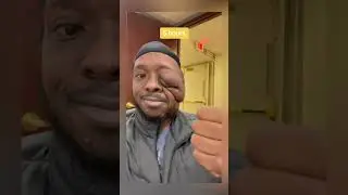Count down to getting brain tumor removed! (Full recovery video tagged above ❤️)