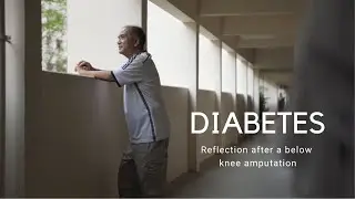 Diabetes: Reflection after a below knee amputation