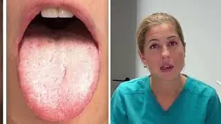 lengua