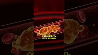 Останови рост бляшек 