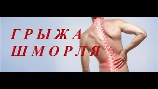 ГРЫЖА  ШМОРЛЯ. Ответы на ваши вопросы